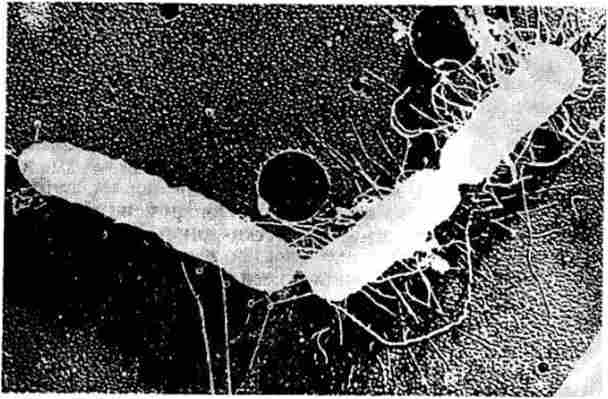 Електронна мікрофотографія кон'югації між бактеріальними клітинами Hfr і F ~