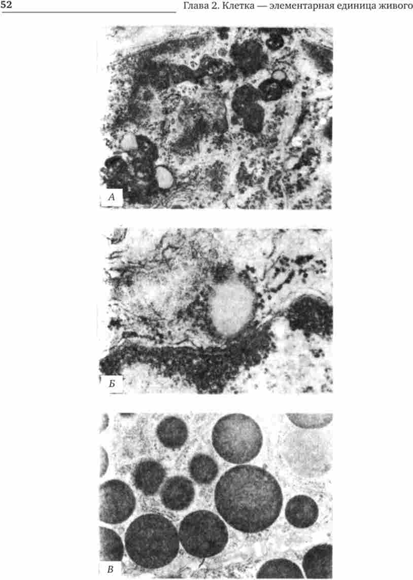 Цитоплазматичні включення еукаріотичної клітини