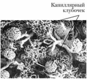 Капілярні (мальпігієві) клубочки (електронна скануюча мікроскопія)