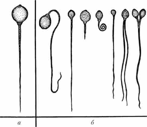 Нормальний сперматозоїд людини (а) і видозмінені сперматозоїди, нездатні до запліднення (б)