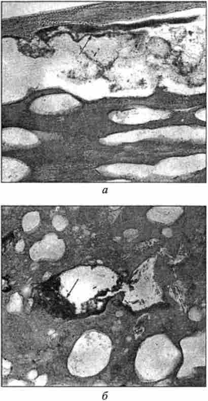 Мікроструктура вареної ковбаси, експериментально контамінована бактеріями Yersinia enterocolitica. Забарвлення гематоксиліном і еозином, окуляр х7
