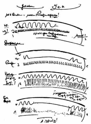 Сторінка з книги Г. Бергера, що ілюструє перший запис ЕЕГ людини